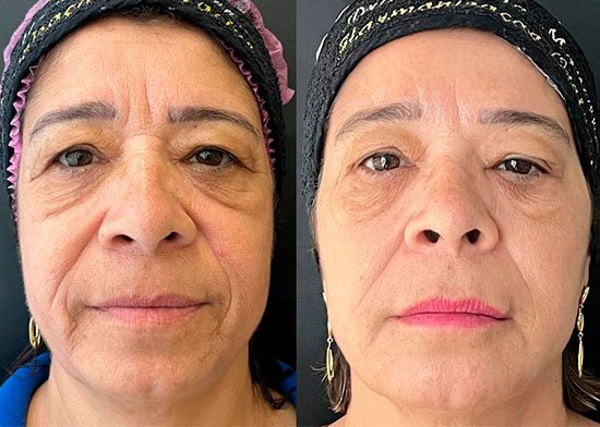 Método Mancilha - Consultório Dra Marisa Mancilha